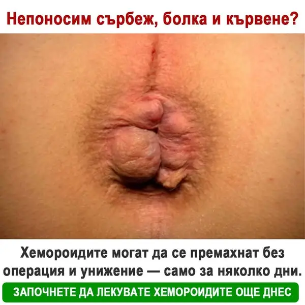 Кадр рекламы ApexCare