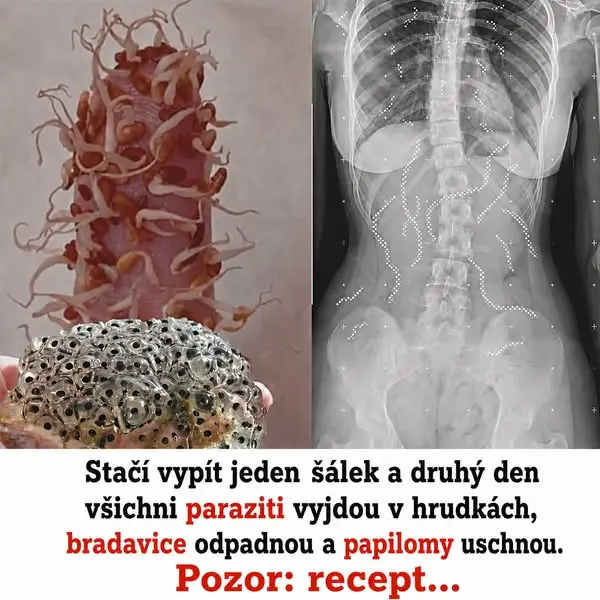 Кадр рекламы Dr.Agnes