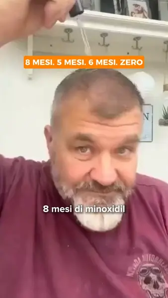 Кадр рекламы Microfol