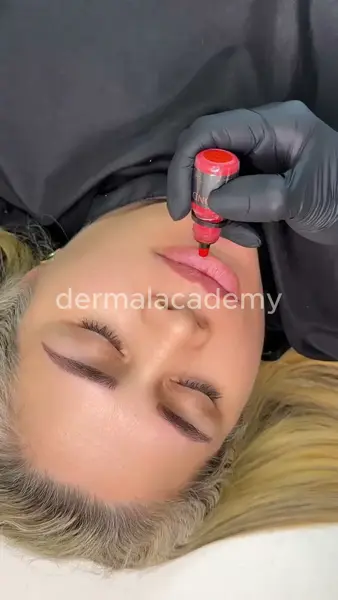 Кадр рекламы Academy Dermal