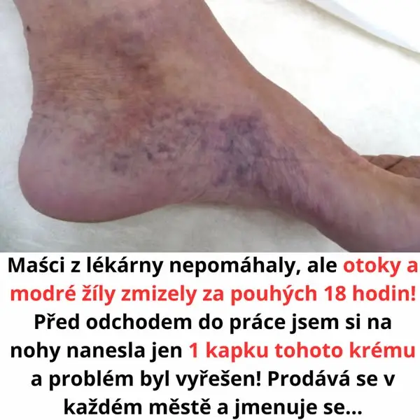 Кадр рекламы Dert medutr