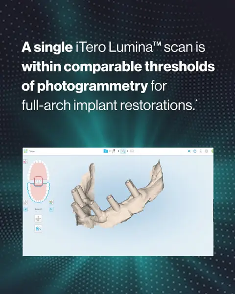 Кадр рекламы iTero Intraoral Scanner