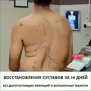 Кадр рекламы Navarrrofet
