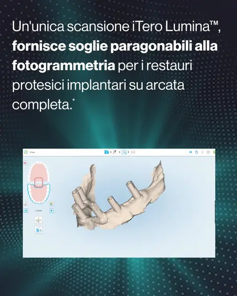 Кадр рекламы iTero Intraoral Scanner