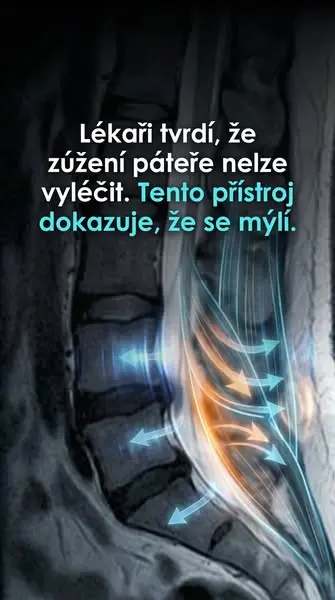 Кадр рекламы Volný pohyb každý den