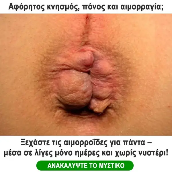 Кадр рекламы MedNova1589