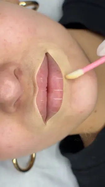 Кадр рекламы Academy Dermal