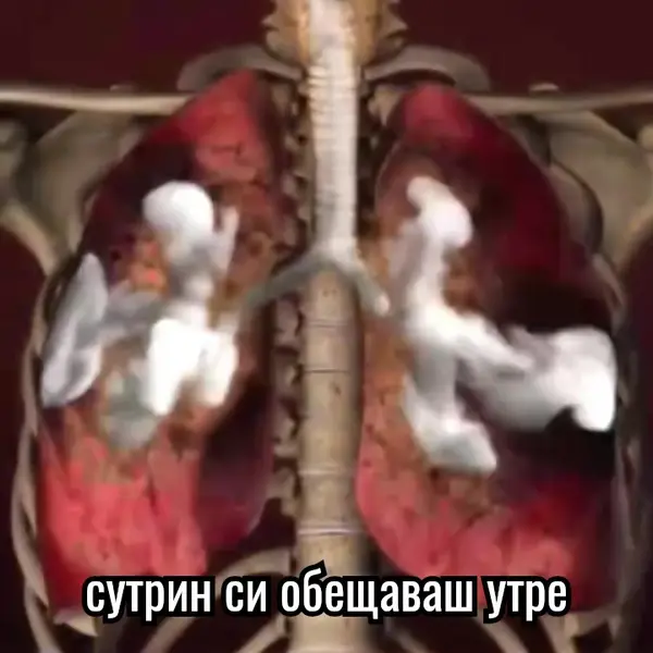Кадр рекламы Easy health