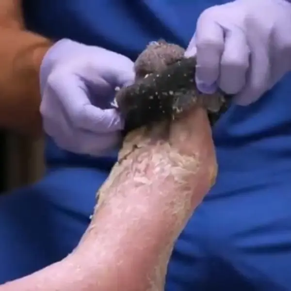 Кадр рекламы Dermavia
