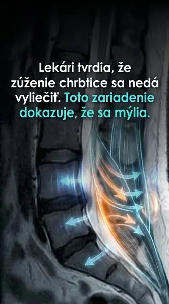 Кадр рекламы Voľný pohyb každý deň