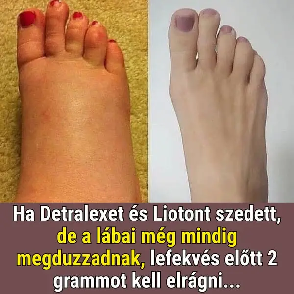Кадр рекламы Dert medutr