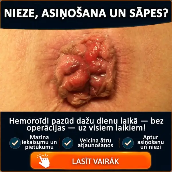 Кадр рекламы Dr.Lina