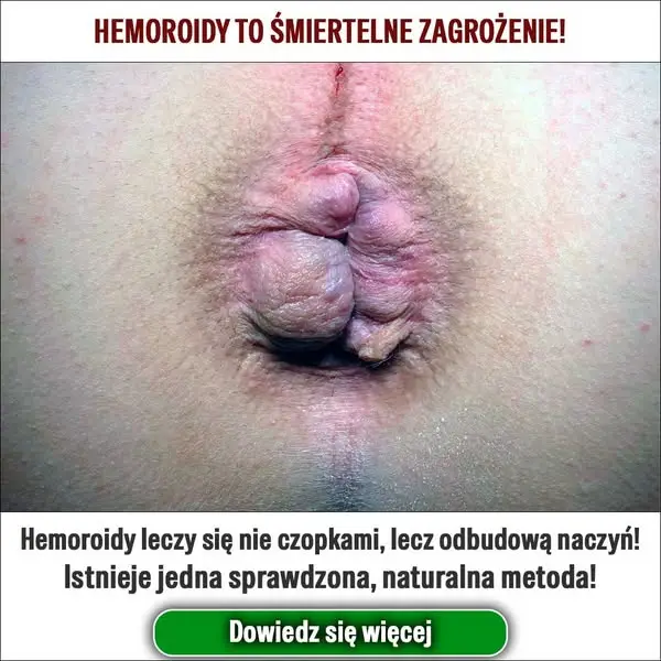 Кадр рекламы MedPulse3571