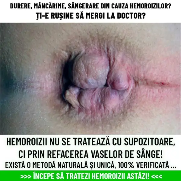 Кадр рекламы MedPulse3571