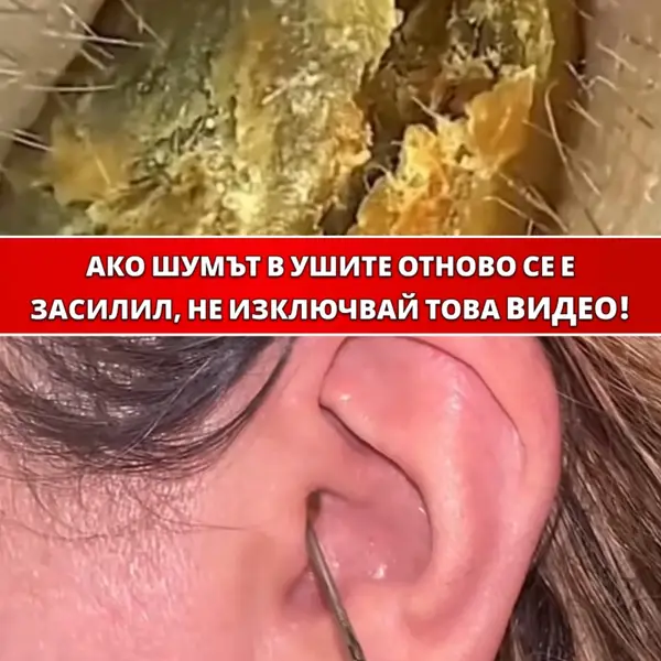Кадр рекламы BioMed