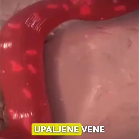 Кадр рекламы Medical Healt